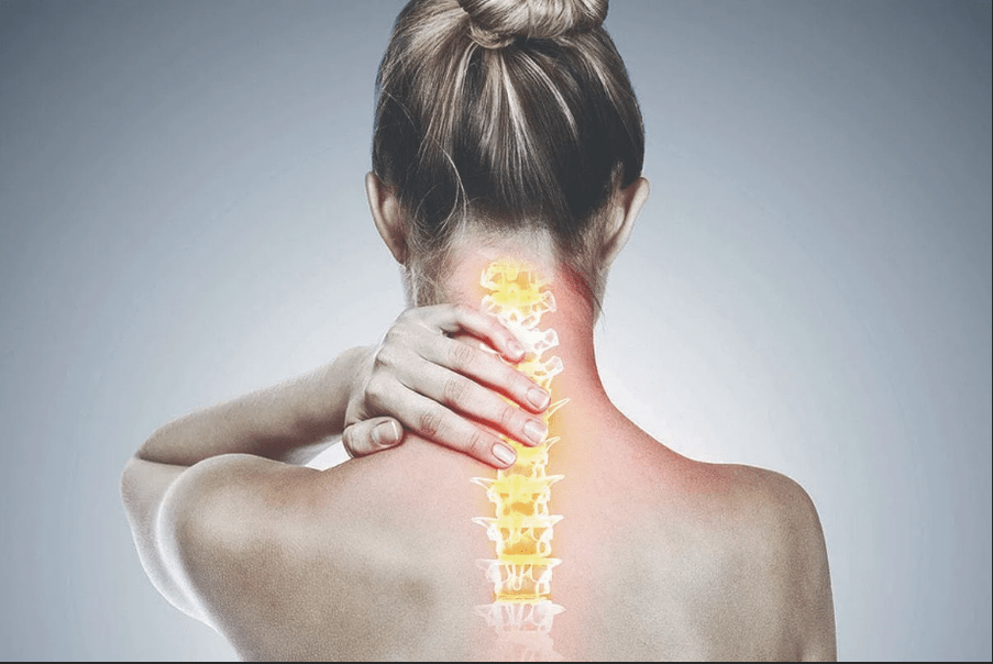 cervical osteochondrosis