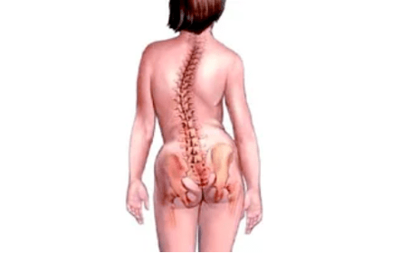 The reasons for the development of cervical osteochondosis