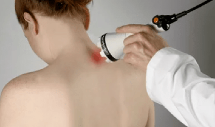 Treatment of cervical osteocondrosis through physiotherapy