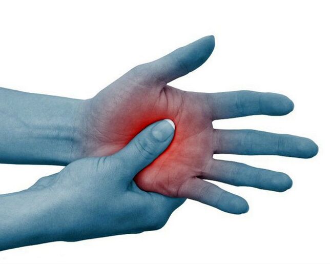 Severe pain in the finger joints, which decreases with exercise, is a typical sign of rheumatoid arthritis. 